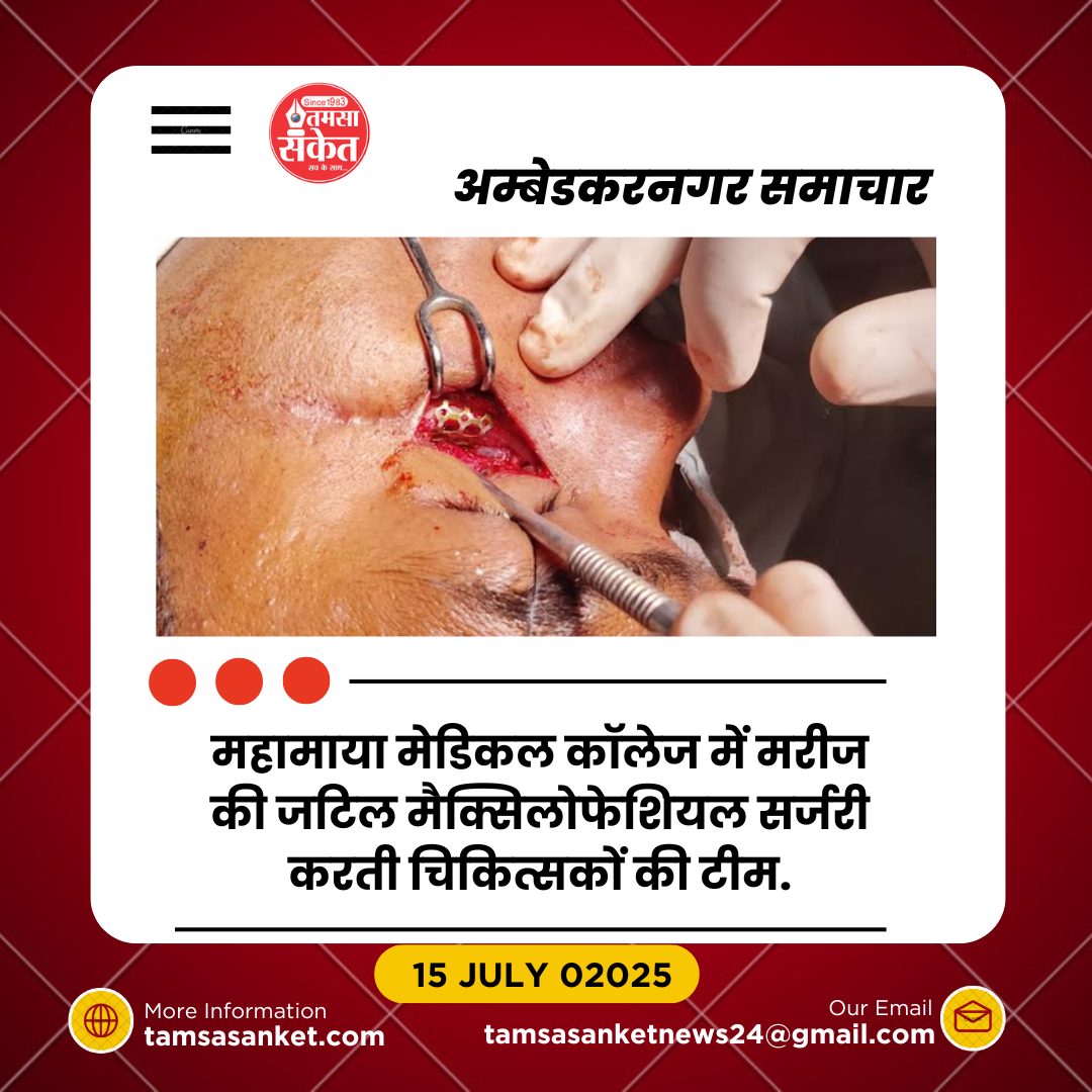 महामाया मेडिकल कॉलेज में जटिल जबड़ा सर्जरी सफल