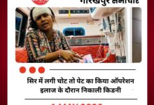सिर में लगी चोट तो पेट का किया ऑपरेशन, इलाज के दौरान निकाली किडनी