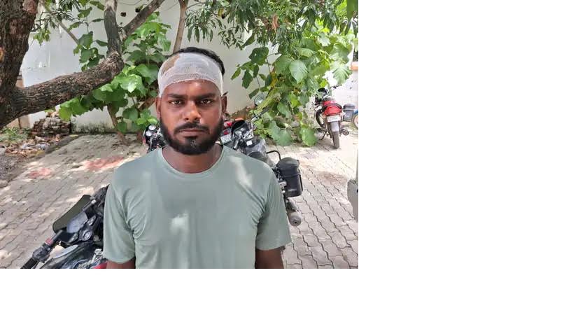 अंबेडकरनगर के जलालपुर में जानलेवा हमले के बाद पुलिस जांच का दृश्य।