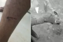 लखनऊ के गोमतीनगर में आवारा कुत्तों के हमले और नगर निगम की कार्रवाई का सांकेतिक चित्र।