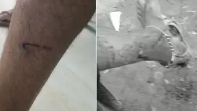 लखनऊ के गोमतीनगर में आवारा कुत्तों के हमले और नगर निगम की कार्रवाई का सांकेतिक चित्र।