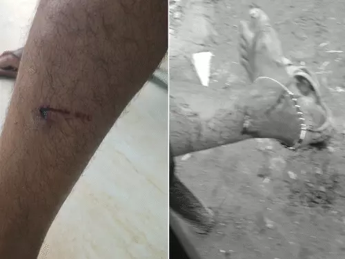 लखनऊ के गोमतीनगर में आवारा कुत्तों के हमले और नगर निगम की कार्रवाई का सांकेतिक चित्र।