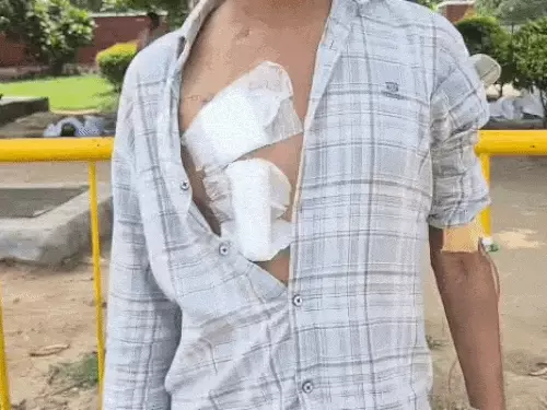 किडनी ट्रांसप्लांट फेल होने के बाद डायलिसिस करा रहे अल्ताफ और उनके पिता