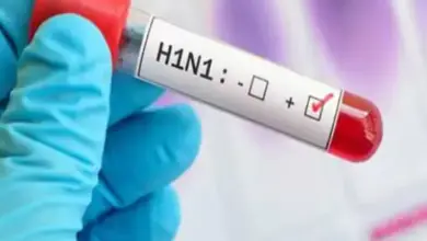 इंदौर में स्वाइन फ्लू और H1N1 संक्रमण से जुड़ी खबर