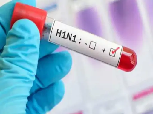 इंदौर में स्वाइन फ्लू और H1N1 संक्रमण से जुड़ी खबर