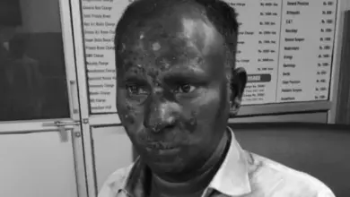 गोमतीनगर विस्तार में हाईटेंशन लाइन के फाल्ट के दौरान हादसे के बाद बिजली उपकेंद्र का दृश्य
