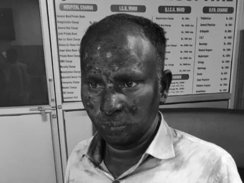 गोमतीनगर विस्तार में हाईटेंशन लाइन के फाल्ट के दौरान हादसे के बाद बिजली उपकेंद्र का दृश्य