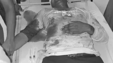 मलिहाबाद में LIC एजेंट पर फायरिंग की घटना के बाद मौके पर पुलिस।
