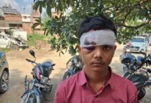 अंबेडकरनगर के जलालपुर में रामलीला देखकर लौट रहे युवक से मारपीट के मामले से संबंधित तस्वीर।