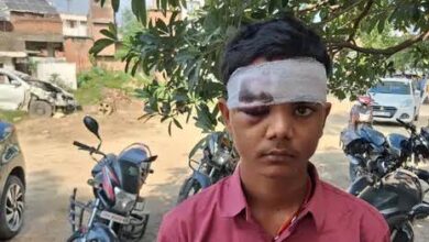 अंबेडकरनगर के जलालपुर में रामलीला देखकर लौट रहे युवक से मारपीट के मामले से संबंधित तस्वीर।