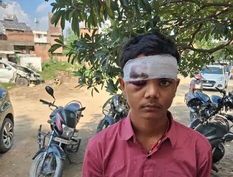 अंबेडकरनगर के जलालपुर में रामलीला देखकर लौट रहे युवक से मारपीट के मामले से संबंधित तस्वीर।